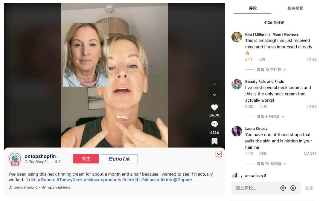 TikTok网红加持，美颈霜10个月销售神话：逼近1700万美元大关！