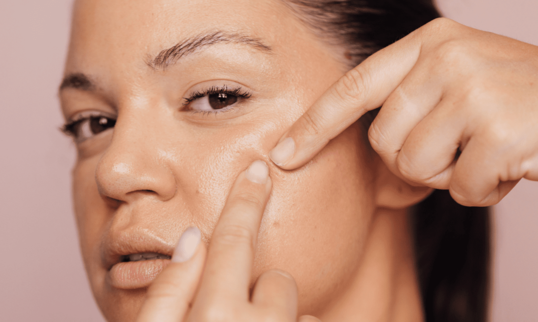 不遮痘反爆火！巴西TikTok美妆贴7天爆卖608万