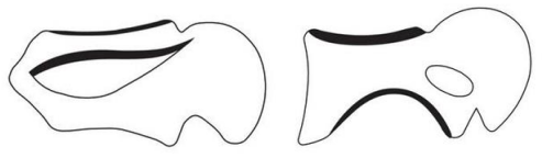 侵权大扫荡!1100+店铺被起诉,有卖这些产品的立即下架!